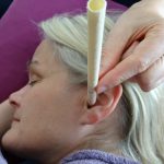 Thermo Auricular therapy